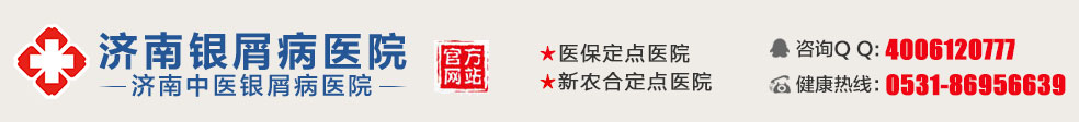 济南银屑病医院,济南银屑病医院
